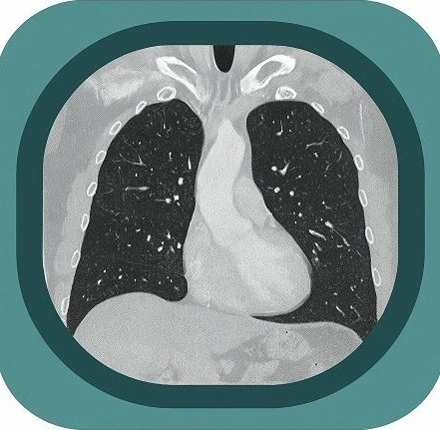 ct chest lung window anatomy